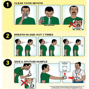 Instructions for collecting sputum for Tuberculosis Test 